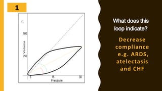 302928272625242322212019181716151413121110987654321
Decrease
compliance
e.g. ARDS,
atelectasis
and CHF
 
