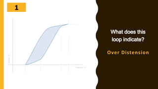 302928272625242322212019181716151413121110987654321
Over Distension
 