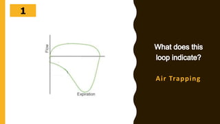 302928272625242322212019181716151413121110987654321
Air Trapping
 