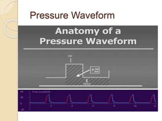 Pressure Waveform
 