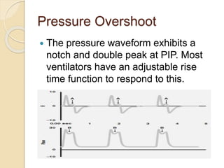 Pressure Overshoot
 The pressure waveform exhibits a
notch and double peak at PIP. Most
ventilators have an adjustable rise
time function to respond to this.
 