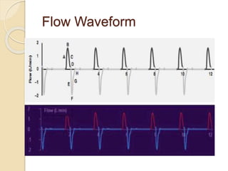 Flow Waveform
 