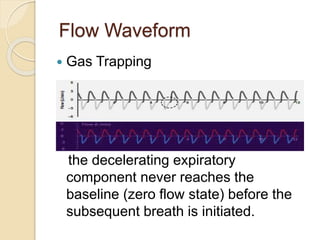 Flow Waveform
 Gas Trapping
the decelerating expiratory
component never reaches the
baseline (zero flow state) before the
subsequent breath is initiated.
 