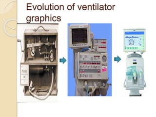 Evolution of ventilator
graphics
 