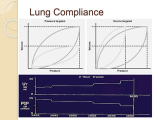 Lung Compliance
 