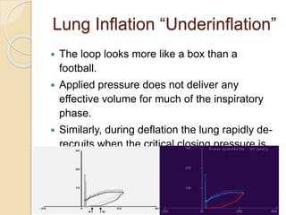 Lung Inflation “Underinflation”
 The loop looks more like a box than a
football.
 Applied pressure does not deliver any
effective volume for much of the inspiratory
phase.
 Similarly, during deflation the lung rapidly de-
recruits when the critical closing pressure is
reached.
 