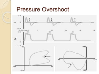 Pressure Overshoot
 