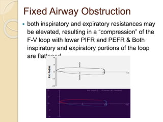 Fixed Airway Obstruction
 both inspiratory and expiratory resistances may
be elevated, resulting in a “compression” of the
F-V loop with lower PIFR and PEFR & Both
inspiratory and expiratory portions of the loop
are flattened.
 