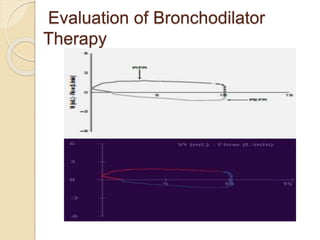 Evaluation of Bronchodilator
Therapy
 