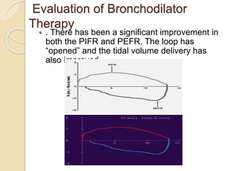 Evaluation of Bronchodilator
Therapy
 . There has been a significant improvement in
both the PIFR and PEFR. The loop has
“opened” and the tidal volume delivery has
also improved
 