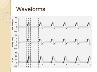 Waveforms
 