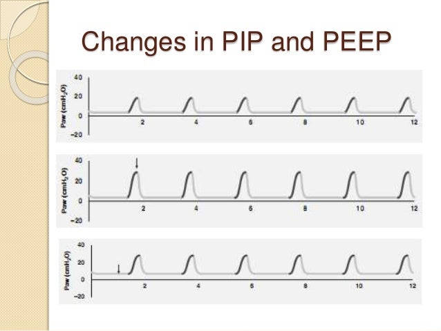 pip in mechanical ventilation pip in mechanical ventilation