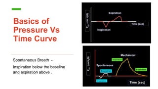 Basics of
Pressure Vs
Time Curve
Spontaneous Breath -
Inspiration below the baseline
and expiration above .
 