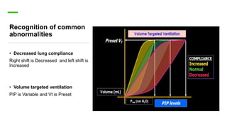 Recognition of common
abnormalities
• Decreased lung compliance
Right shift is Decreased and left shift is
Increased
• Volume targeted ventilation
PIP is Variable and Vt is Preset
 