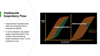 Inadequate
Inspiratory Flow
• Inappropriate Inspiratory flow
rates are recognized from a
scooped-out pattern.
• In some situations, the patient
makes inspiratory effort in the
middle of the mechanical
breath exhibiting “notch” on the
inspiratory curve.
 