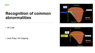 Recognition of common
abnormalities
• Air Leak
• Auto Peep / Air trapping
 