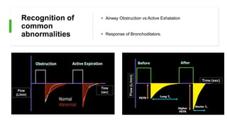 Recognition of
common
abnormalities
• Airway Obstruction vs Active Exhalation
• Response of Bronchodilators.
 