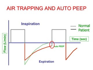 AIR TRAPPING AND AUTO PEEP
Inspiration
Expiration
Normal
Patient
Time (sec)
Flow
(L/min)
Auto PEEP
 