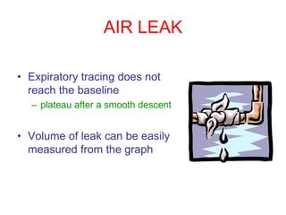 AIR LEAK
• Expiratory tracing does not
reach the baseline
– plateau after a smooth descent
• Volume of leak can be easily
measured from the graph
 