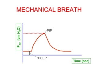 MECHANICAL BREATH
P
aw
(cm
H
2
O)
Time (sec)
PEEP
PIP
 