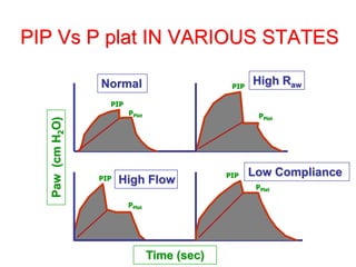 PIP Vs P plat IN VARIOUS STATES
Normal High Raw
High Flow
Low Compliance
Time (sec)
Paw
(cm
H
2
O)
PIP
PPlat
PIP
PIP PIP
PPlat
PPlat
PPlat
 