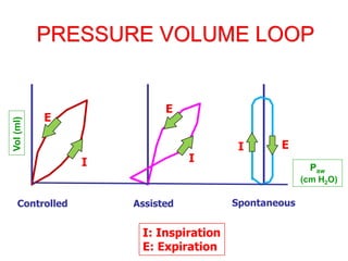 PRESSURE VOLUME LOOP
Controlled Assisted Spontaneous
Vol
(ml)
Paw
(cm H2O)
I: Inspiration
E: Expiration
I
E
E
E
I
I
 