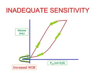 INADEQUATE SENSITIVITY
Volume
(mL)
Paw (cm H2O)
Increased WOB
 
