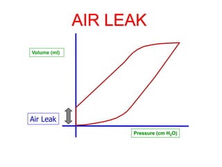 AIR LEAK
Volume (ml)
Pressure (cm H2O)
Air Leak
 