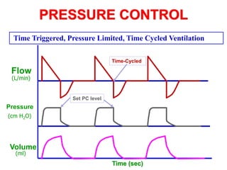 PRESSURE CONTROL
Pressure
Flow
Volume
(L/min)
(cm H2O)
(ml)
Time (sec)
Time-Cycled
Set PC level
Time Triggered, Pressure Limited, Time Cycled Ventilation
 