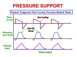 PRESSURE SUPPORT
Time (sec)
Flow
(L/m)
Pressure
(cm H2O)
Volume
(mL)
Flow Cycling
Set PS
level
Patient Triggered, Flow Cycled, Pressure limited Mode
 