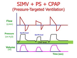 Pressure
Flow
Volume
(L/min)
(cm H2O)
(ml)
Set PC level
Time (sec)
SIMV + PS + CPAP
(Pressure-Targeted Ventilation)
Set PS level
CPAP level
 