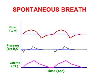 SPONTANEOUS BREATH
Time (sec)
Flow
(L/m)
Pressure
(cm H2O)
Volume
(mL)
 