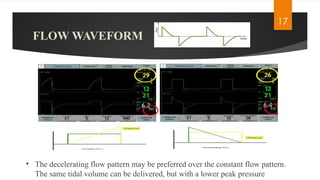 VENTILATOR GRAPHICS,Purposes of monitoring graphics | PPTX