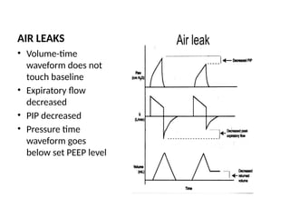 MECHANICAL VENTILATOR GRAPHICS INTERPRETATION.pptx