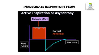 INADEQUATE INSPIRATORY FLOW
 
