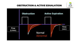 OBSTRUCTION & ACTIVE EXHALATION
 