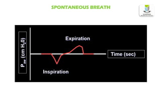 SPONTANEOUS BREATH
 