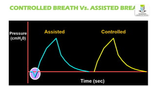 CONTROLLED BREATH Vs. ASSISTED BREATH
 