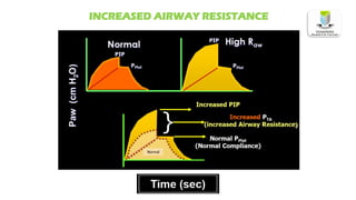 INCREASED AIRWAY RESISTANCE
 
