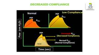DECREASED COMPLIANCE
 
