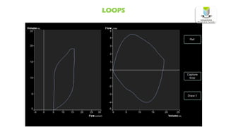 LOOPS
 
