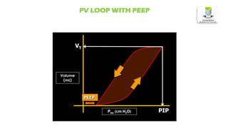 PV LOOP WITH PEEP
 