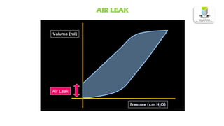 AIR LEAK
 