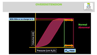 OVERDISTENSION
 