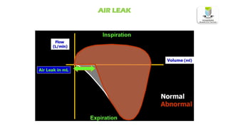 AIR LEAK
 