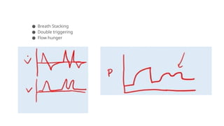 ● Breath Stacking
● Double triggering
● Flow hunger
 