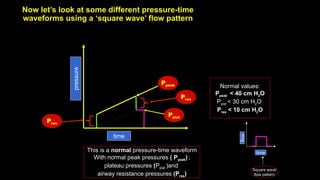 Now let’s look at some different pressure-time
waveforms using a ‘square wave’ flow pattern
This is a normal pressure-time waveform
With normal peak pressures ( Ppeak) ;
plateau pressures (Pplat )and
airway resistance pressures (Pres)
time
pressure
Ppeak
Pres
Pplat
Pres
time
flow
‘Square wave’
flow pattern
Normal values:
Ppeak < 40 cm H2O
Pplat < 30 cm H2O
Pres < 10 cm H2O
 