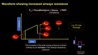 Waveform showing increased airways resistance
time
pressure
Ppeak
Pres
Pplat
Pres
The increase in the peak airway pressure is driven
entirely by an increase in the airways resistance
pressure.
e.g. ET tube
blockage
Paw = Flow Resistance + Volume + PEEP
Compliance
time
flow
‘Square wave’
flow pattern
Normal
 