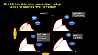 Now lets look at the same pressure-time tracings
using a ‘decelerating ramp’ flow pattern
High Raw:
(e.g. asthma)
Normal
High flow:
(Note short
Inspiratory
time)
Low CL:
e.g. ARDS
Normal
PIP
Normal
Pplat
High
PIP
High
PIP
High
Pplat
Normal
Pplat
Normal
Pplat
High
PIP
pressure
time
 