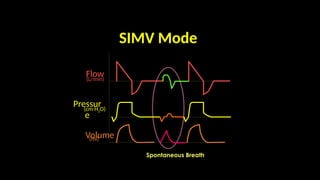 Pressur
e
Flow
Volume
(L/min)
(cm H2O)
(ml)
Time (sec)
SIMV Mode
Spontaneous Breath
 